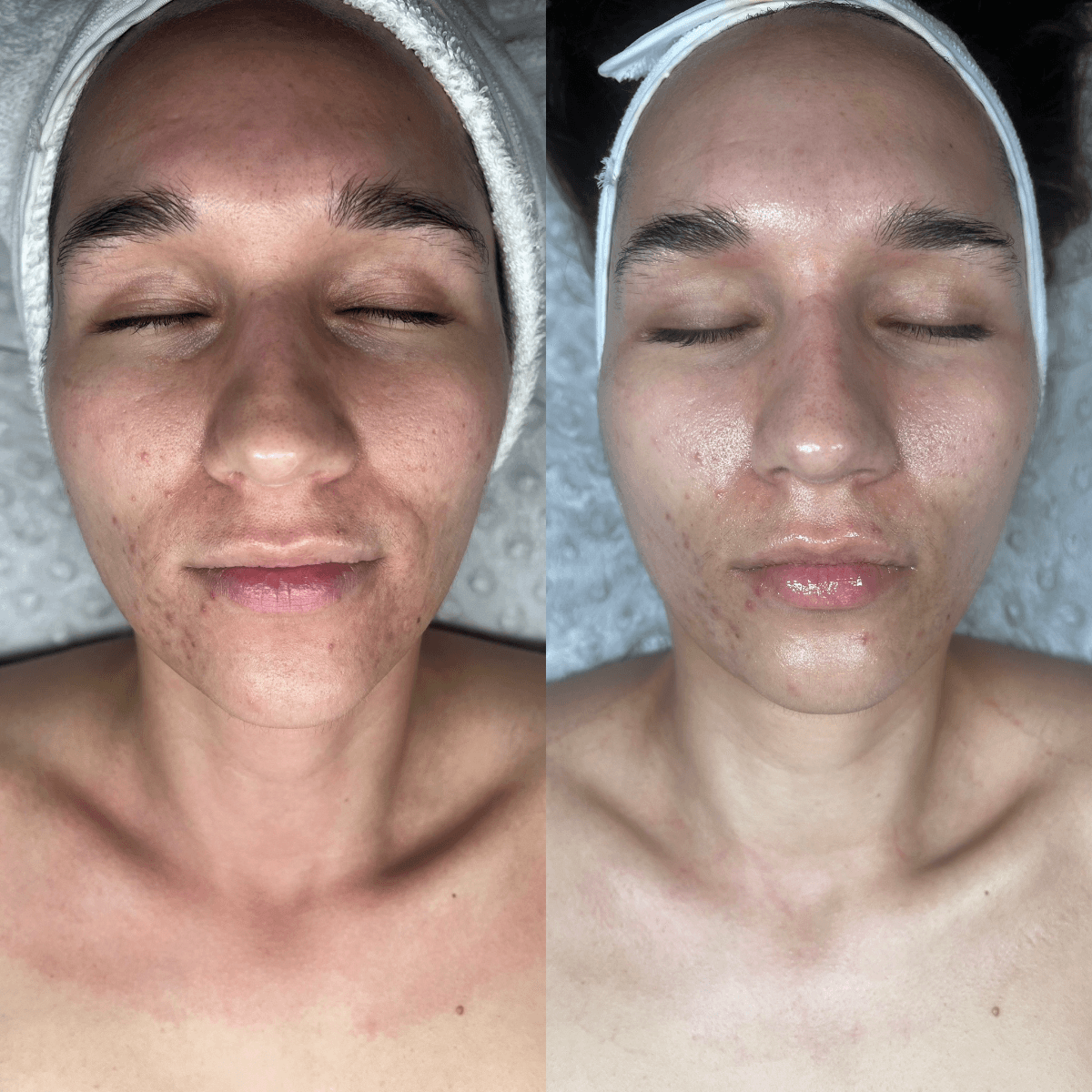 Before and After