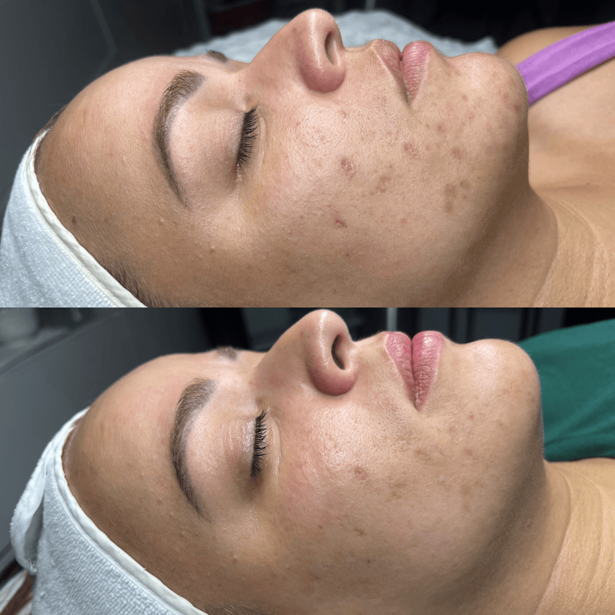 Before and After