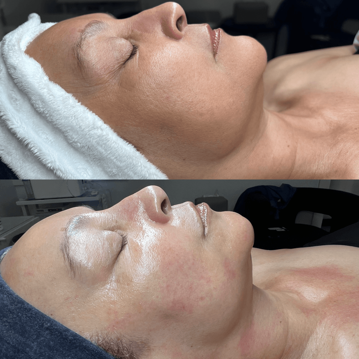 Before and After