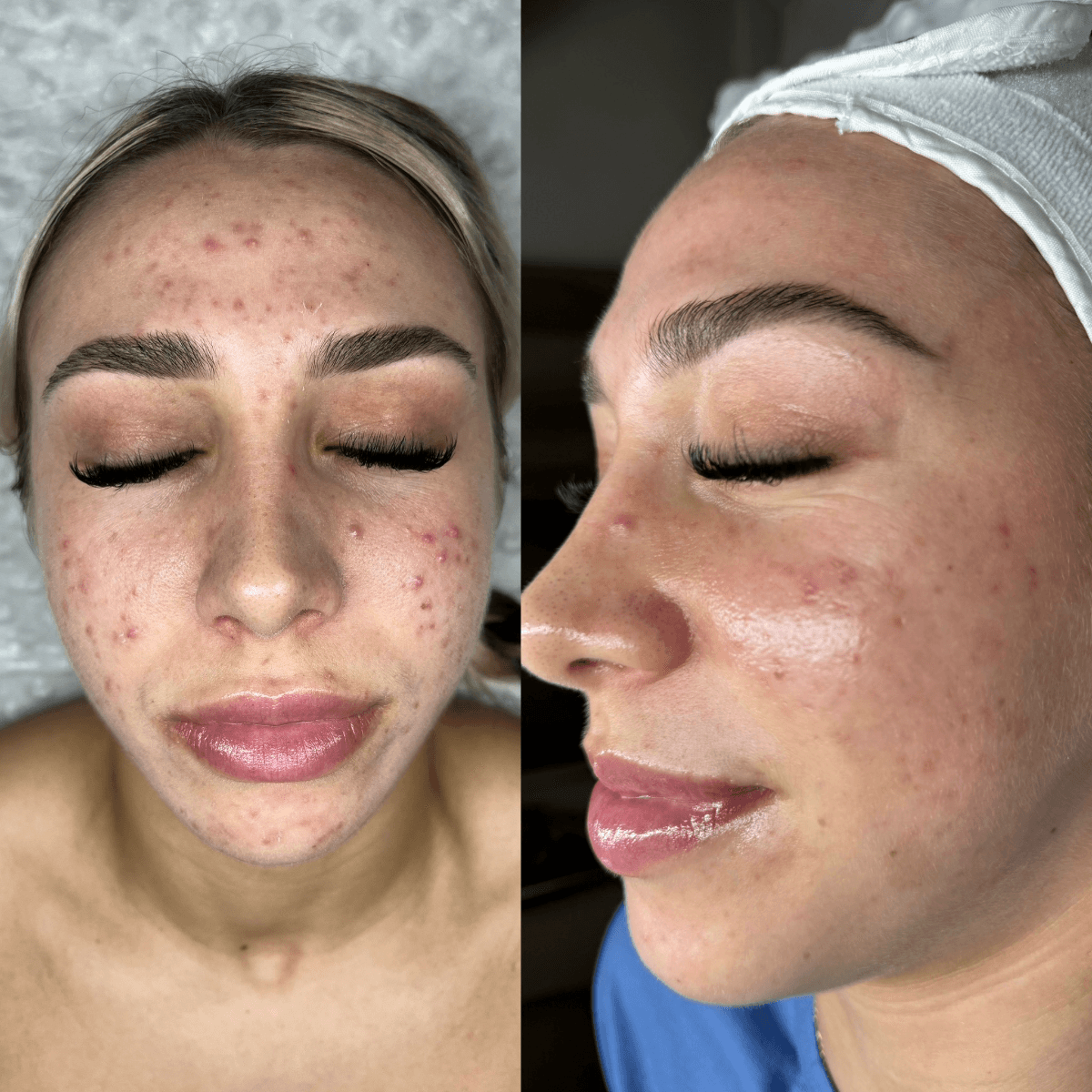 Before and After